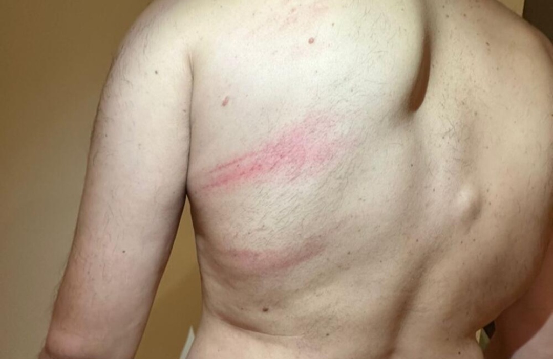 Podgoričanin demantuje da je napao policajce: Pretukli me, vrijeđali i ponižavali, primio sam pet injekcija